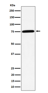 Western blot analysis of PPM1G expression in human Jurkat cell lysate using PPM1G antibody. Predicted molecular weight ~59 kDa, commonly observed at 59-75 kDa.