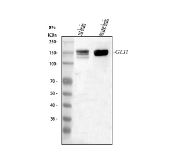 Western blot analysis of GLI1 using anti-GLI1 antibody. Lane 1: rat brain tissue lysates, Lane 2: mouse brain tissue lysates. After electrophoresis, proteins were transferred to a nitrocellulose membrane at 150 mA for 50-90 minutes. Blocked the membrane with 5% non-fat milk/TBS for 1.5 hour at RT. The membrane was incubated with rabbit anti-GLI1 antibody at 0.5 ug/ml overnight at 4oC, then washed with TBS-0.1%Tween 3 times with 5 minutes each and probed with a goat anti-rabbit IgG-HRP secondary antibody at a dilution of 1:5000 for 1.5 hour at RT. The signal was developed using enhanced chemiluminescent. The expected band size for GLI1 is 100-160 kDa.