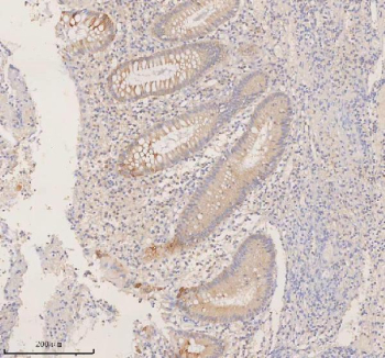 Immunohistochemical staining of RIGI using anti-RIGI antibody. RIGI was detected in a paraffin-embedded section of human appendicitis tissue. Heat mediated antigen retrieval was performed in EDTA buffer (pH 8.0, epitope retrieval solution). The tissue section was blocked with 10% goat serum. The tissue section was then incubated with 2 ug/ml rabbit anti-RIGI antibody overnight at 4oC. Peroxidase Conjugated Goat Anti-rabbit IgG was used as secondary antibody and incubated for 30 minutes at 37oC. The tissue section was developed using an HRP secondary and DAB substrate.