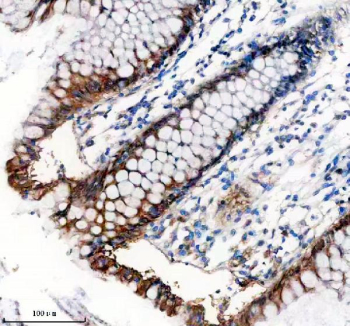 Immunohistochemical staining of TNS4 using anti-TNS4 antibody. TNS4 was detected in a paraffin-embedded section of human colon tissue. Heat mediated antigen retrieval was performed in EDTA buffer (pH 8.0, epitope retrieval solution). The tissue section was blocked with 10% goat serum. The tissue section was then incubated with 2 ug/ml rabbit anti-TNS4 antibody overnight at 4oC. Peroxidase Conjugated Goat Anti-rabbit IgG was used as secondary antibody and incubated for 30 minutes at 37oC. The tissue section was developed using an HRP secondary and DAB substrate.