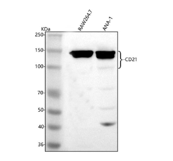 Western blot analysis of CD21/CR2 using anti-CD21 antibody. Lane 1: mouse Raw264.7 whole cell lysates, Lane 2: mouse Ana-1 whole cell lysates. After electrophoresis, proteins were transferred to a nitrocellulose membrane at 150 mA for 50-90 minutes. Blocked the membrane with 5% non-fat milk/TBS for 1.5 hour at RT. The membrane was incubated with rabbit anti-CD21 antibody at 0.5 ug/ml overnight at 4oC, then washed with TBS-0.1%Tween 3 times with 5 minutes each and probed with a goat anti-rabbit IgG-HRP secondary antibody at a dilution of 1:5000 for 1.5 hour at RT. The signal was developed using enhanced chemiluminescent. The expected band size for CD21/CR2 is at 110-120 kDa (multiple isoforms), but it may be observed at higher molecular weights due to glycosylation.