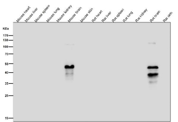 All lanes use the Phospho-MAP2 (Ser136) antibody at 1:1K dilution for 1 hour at room temperature. Phospho-MAP2 (Ser136) signal was detected only in brain lysates, consistent with MAP2 being a neuron-specific protein that is naturally phosphorylated in neural tissue and absent from non-neural organs such as liver, spleen, lung, kidney, and skin.