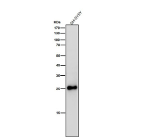 All lanes use the SNAP25 antibody at 1:3K dilution for 1 hour at room temperature.