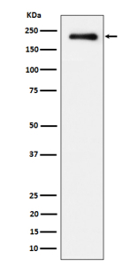 Western blot analysis of Phospho-EGFR (Y869) expression in treated with EGF cell lysate using Phospho-EGFR (Tyr845) antibody.