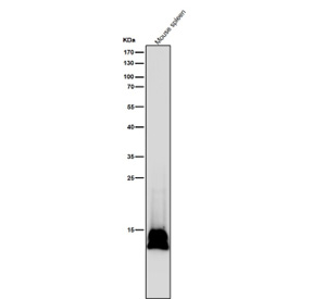 All lanes use the Histone H2B (formyl K116) antibody at 1:5K dilution for 1 hour at room temperature.
