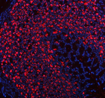 Immunofluorescent staining of ATP4B using anti-ATP4B antibody (red). ATP4B was detected in a paraffin-embedded section of rat stomach tissue. Heat mediated antigen retrieval was performed in EDTA buffer (pH 8.0, epitope retrieval solution). The tissue section was blocked with 10% goat serum. The tissue section was then incubated with 5 ug/ml rabbit anti-ATP4B antibody overnight at 4oC. DyLight 594 Conjugated Goat Anti-Rabbit IgG was used as secondary antibody at 1:500 dilution and incubated for 30 minutes at 37oC. The section was counterstained with DAPI nuclear stain (blue). Visualize using a fluorescence microscope and filter sets appropriate for the label used.