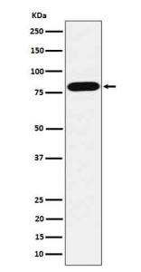 Western blot analysis of ABCD1 / ALD in HepG2 cell lysate using ABCD1 antibody.