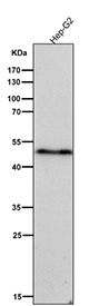All lanes use the Phospho-VASP (Ser156) antibody at 1:5K dilution for 1 hour at room temperature.