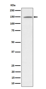 Western blot analysis of phospho-Phospholipase C gamma 1/PLC-gamma-1 (Y1253) expression in Jurkat treated with Pervanadate lysate, using Phospho-Phospholipase C gamma 1 (Tyr1253) antibody.