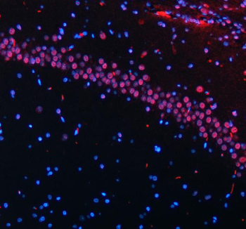 Immunofluorescent staining of FFPE rat brain tissue with HTATSF1 antibody (red) and DAPI nuclear stain (blue). HIER: steam section in pH8 EDTA buffer for 20 min.