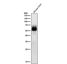 Western blot testing of mouse brain tissue lysate with Phospho-Chk2 (Ser33/Ser35) antibody at 1:1000 dilution for 1 hour at room temperature. Predicted molecular weight ~61 kDa.