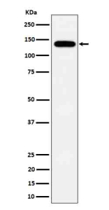 Western blot analysis of Tripeptidyl peptidase II expression in HepG2 cell lysate using TPP2 antibody. Predicted molecular weight ~138 kDa.
