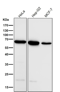 All lanes use the ACADVL antibody at 1:5000 dilution for 1 hour at room temperature. Predicted molecular weight ~68 kDa.