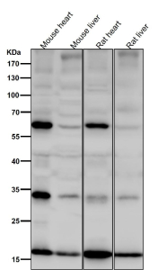 All lanes use the SDHC antibody at 1:6K dilution for 1 hour at room temperature. Predicted molecular weight: 12-19 kDa (multiple isoforms). Bands seen at higher molecular weights may represent SDHC heterodimers.