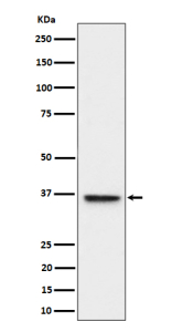 Western blot analysis of ULBP1 expression in HeLa cell lysate using ULBP1 antibody. ULBP1 (~28 kDa predicted) seen here at ~36 kDa in Western blot is consistent with its known glycosylation and postâtranslational modifications.