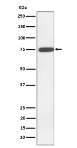 Western blot analysis of GNE expression in K562 cell lysate using GNE antibody. Predicted molecular weight: 67-83 kDa (multiple isoforms).