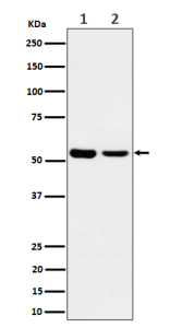 Western blot analysis of AAMP expression in (1) lysate; (2) MCF7 cell lysate using AAMP antibody. Predicted molecular weight: ~47 kDa.