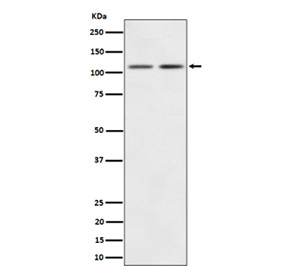 Western blot analysis of Kinase beta expression in (1) human 293 cell lysate; (2) mouse Brain lysate using PIK3CB antibody. Predicted molecular weight ~110 kDa.
