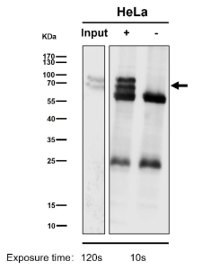Immunoprecipitation analysis using the antibody at 1:50 dilution. Western blot testing at 1:1K dilution. Predicted molecular weight: 46-90 kDa (multiple isoforms).
