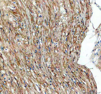 Immunohistochemical staining of TGFBI using anti-TGFBI antibody. TGFBI was detected in a paraffin-embedded section of human intestinal smooth muscle tissue. Heat mediated antigen retrieval was performed in EDTA buffer (pH 8.0, epitope retrieval solution). The tissue section was blocked with 10% goat serum. The tissue section was then incubated with 2 ug/ml rabbit anti-TGFBI antibody overnight at 4oC. Peroxidase Conjugated Goat Anti-rabbit IgG was used as secondary antibody and incubated for 30 minutes at 37oC. The tissue section was developed using an HRP secondary and DAB substrate.