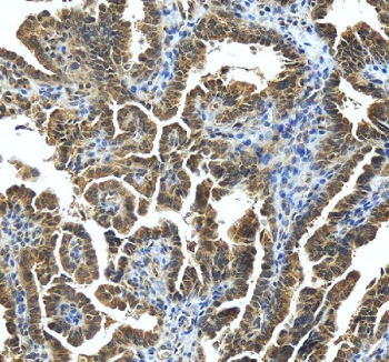 Immunohistochemical staining of STRBP using anti-STRBP antibody. STRBP was detected in a paraffin-embedded section of mouse brain tissue. Heat mediated antigen retrieval was performed in EDTA buffer (pH 8.0, epitope retrieval solution). The tissue section was blocked with 10% goat serum. The tissue section was then incubated with 2 ug/ml rabbit anti-STRBP antibody overnight at 4oC. Peroxidase Conjugated Goat Anti-rabbit IgG was used as secondary antibody and incubated for 30 minutes at 37oC. The tissue section was developed using an HRP secondary and DAB substrate.