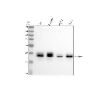 Western blot analysis of 4EBP1/EIF4EBP1/2/3(Phospho-T46/T46/T32) using anti-Phospho-eIF4EBP1 (Thr46) antibody. Electrophoresis was performed on a 12% SDS-PAGE gel at 80V (Stacking gel) / 120V (Resolving gel) for 2 hours. Lane 1: human HEL whole cell lysates, Lane 2: human SH-SY5Y whole cell lysates, Lane 3: human HepG2 whole cell lysates, Lane 4: human MCF-7 whole cell lysates. After electrophoresis, proteins were transferred to a nitrocellulose membrane at 150 mA for 50-90 minutes. Blocked the membrane with 5% non-fat milk/TBS for 1.5 hour at RT. The membrane was incubated with rabbit anti-4EBP1/EIF4EBP1/2/3(Phospho-T46/T46/T32) antibody at 1:500 overnight at 4oC, then washed with TBS-0.1%Tween 3 times with 5 minutes each and probed with a goat anti-rabbit IgG-HRP secondary antibody at a dilution of 1:5000 for 1.5 hour at RT. The signal was developed using an ECL Plus Western Blotting Substrate. A specific band was detected for 4EBP1/EIF4EBP1/2/3(Phospho-T46/T46/T32) at approximately 18 kDa. The expected molecular weight of 4EBP1/EIF4EBP1/2/3(Phospho-T46/T46/T32) is at 18 kDa.