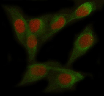 Immunofluorescent staining of FOXC2 using anti-FOXC2 antibody (red) and anti-Tubulin Alpha antibody (green). FOXC2 was detected in immunocytochemical section of Hela cell. Enzyme antigen retrieval was performed using IHC enzyme antigen retrieval reagent for 15 mins. The cells were blocked with 10% goat serum. And then incubated with 5 ug/ml rabbit anti-FOXC2 antibody and mouse anti-Tubulin Alpha antibody overnight at 4oC. Cy3 Conjugated Goat Anti-Rabbit IgG and FITC Conjugated Goat Anti-Mouse IgG were used as secondary antibody at 1:500 dilution and incubated for 30 minutes at 37oC. Visualize using a fluorescence microscope and filter sets appropriate for the label used.