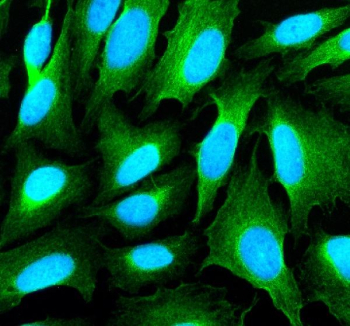 Immunofluorescent staining of SHANK1 using anti-SHANK1 antibody (green). SHANK1 was detected in an immunocytochemical section of U2OS cells. Enzyme antigen retrieval was performed using IHC enzyme antigen retrieval reagent for 15 mins. The cells were blocked with 10% goat serum. And then incubated with 5 ug/ml rabbit anti-SHANK1 antibody overnight at 4oC. DyLight 488 Conjugated Goat Anti-Rabbit IgG was used as secondary antibody at 1:500 dilution and incubated for 30 minutes at 37oC. The section was counterstained with DAPI nuclear stain (blue). Visualize using a fluorescence microscope and filter sets appropriate for the label used.