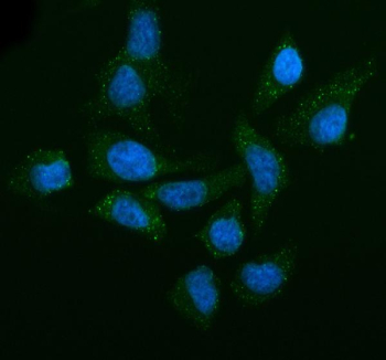 Immunofluorescent staining of LSM14A using anti-LSM14A antibody (green). LSM14A was detected in an immunocytochemical section of HELA cells. Enzyme antigen retrieval was performed using IHC enzyme antigen retrieval reagent for 15 mins. The cells were blocked with 10% goat serum. And then incubated with 5 ug/ml rabbit anti-LSM14A antibody overnight at 4oC. DyLight 488 Conjugated Goat Anti-Rabbit IgG was used as secondary antibody at 1:500 dilution and incubated for 30 minutes at 37oC. The section was counterstained with DAPI nuclear stain (blue). Visualize using a fluorescence microscope and filter sets appropriate for the label used.