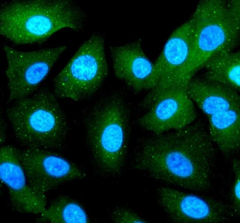 Immunofluorescent staining of RBCK1 using anti-RBCK1 antibody (green). RBCK1 was detected in an immunocytochemical section of cells. Enzyme antigen retrieval was performed using IHC enzyme antigen retrieval reagent for 15 mins. The cells were blocked with 10% goat serum. And then incubated with 5 ug/ml rabbit anti-RBCK1 antibody overnight at 4oC. DyLight 488 Conjugated Goat Anti-Rabbit IgG was used as secondary antibody at 1:500 dilution and incubated for 30 minutes at 37oC. The section was counterstained with DAPI nuclear stain (blue). Visualize using a fluorescence microscope and filter sets appropriate for the label used.