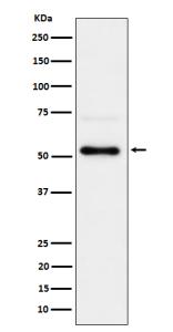 Western blot analysis of Phospho-Chk1 (S280) expression in 293T treated with Calyculin A cell lysate, using Phospho-Chk1 (Ser280) antibody.