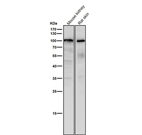 All lanes use the USP5 antibody at 1:1K dilution for 1 hour at room temperature. Predicted molecular weight ~96 kDa.