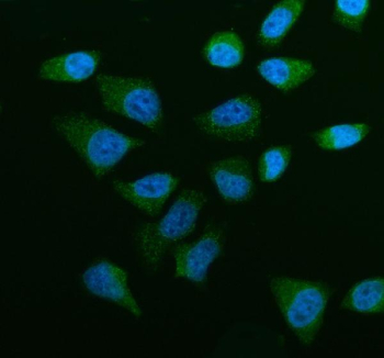 Immunofluorescent staining of OSBPL5 using anti-OSBPL5 antibody (green). OSBPL5 was detected in an immunocytochemical section of HELA cells. Enzyme antigen retrieval was performed using IHC enzyme antigen retrieval reagent for 15 mins. The cells were blocked with 10% goat serum. And then incubated with 5 ug/ml rabbit anti-OSBPL5 antibody overnight at 4oC. DyLight 488 Conjugated Goat Anti-Rabbit IgG was used as secondary antibody at 1:500 dilution and incubated for 30 minutes at 37oC. The section was counterstained with DAPI nuclear stain (blue). Visualize using a fluorescence microscope and filter sets appropriate for the label used.