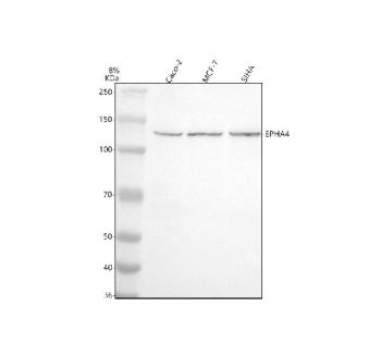 Western blot analysis of EPHA4 using anti-EPHA4 antibody. Electrophoresis was performed on a 8% SDS-PAGE gel at 80V (Stacking gel) / 120V (Resolving gel) for 2 hours. Lane 1: human Caco-2 whole cell lysates, Lane 2: human MCF-7 whole cell lysates, Lane 3: human SIHA whole cell lysates. After electrophoresis, proteins were transferred to a nitrocellulose membrane at 150 mA for 50-90 minutes. Blocked the membrane with 5% non-fat milk/TBS for 1.5 hour at RT. The membrane was incubated with rabbit anti-EPHA4 antibody at 0.5 ug/ml overnight at 4oC, then washed with TBS-0.1%Tween 3 times with 5 minutes each and probed with a goat anti-rabbit IgG-HRP secondary antibody at a dilution of 1:5000 for 1.5 hour at RT. The signal was developed using an ECL Plus Western Blotting Substrate. EPHA4 (~110 kDa predicted) was detected at ~120-130 kDa in Caco-2, MCF-7, and SiHa lysates, consistent with the known upward shift of mature, N-glycosylated EphA4 on SDS-PAGE.