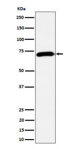 Western blot analysis of Choline Acetyltransferase expression in mouse brain cell lysate using CHAT antibody. Predicted molecular weight ~74 kDa.
