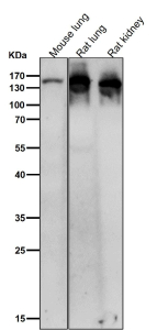 All lanes use the Ceruloplasmin antibody at 1:2K dilution for 1 hour at room temperature. Predicted molecular weight ~130 kDa.