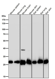 All lanes use the SDHB antibody at 1:3000 dilution for 1 hour at room temperature. Expected molecular weight: 25-32 kDa.