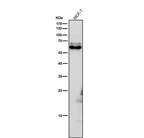 All lanes use the Phospho-CRMP2 (Thr514) antibody at 1:6000 dilution for 1 hour at room temperature. Phospho-CRMP2 (~62 kDa predicted) was detected as a major band at ~63-65 kDa, consistent with phosphorylation at GSK3Î²/CDK5-regulated residues Thr509, Thr514, and Ser522, which slightly retard electrophoretic mobility relative to total CRMP2.
