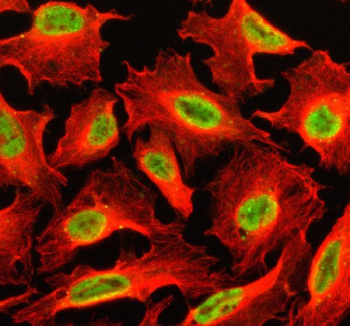 Immunofluorescent staining of SETBP1 using anti-SETBP1 antibody (green) and anti-Beta Tubulin antibody (red). SETBP1 was detected in an immunocytochemical section of U2OS cells. Enzyme antigen retrieval was performed using IHC enzyme antigen retrieval reagent for 15 mins. The cells were blocked with 10% goat serum. And then incubated with 5 ug/ml rabbit anti-SETBP1 antibody and mouse anti-Beta Tubulin antibody overnight at 4oC. DyLight 488 Conjugated Goat Anti-Rabbit IgG and Cy3 Conjugated Goat Anti-Mouse IgG were used as secondary antibody at 1:500 dilution and incubated for 30 minutes at 37oC. Visualize using a fluorescence microscope and filter sets appropriate for the label used.