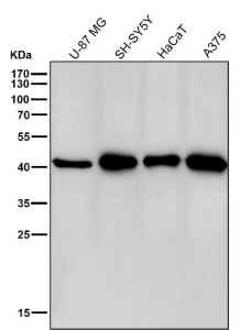 All lanes use the CABP1 antibody at 1:3K dilution for 1 hour at room temperature. Predicted molecular weight ~40 kDa.