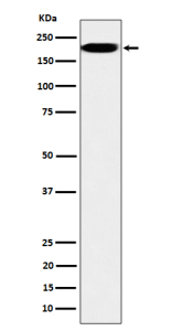 Western blot analysis of IQGAP2 expression in HepG2 cell lysate using IQGAP2 antibody. Predicted molecular weight ~181 kDa.