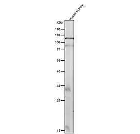 Mouse kidney tissue lysate tested with Phospho-FAK (Tyr576/Tyr577) antibody at 1:2000 dilution for 1 hour at room temperature. Predicted molecular weight ~120 kDa.