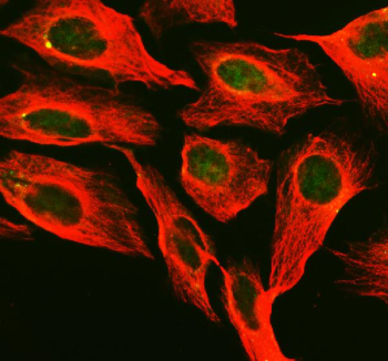 Immunofluorescent staining of PNKP using anti-PNKP antibody (green) and anti-Beta Tubulin antibody (red). PNKP was detected in an immunocytochemical section of U2OS cells. Enzyme antigen retrieval was performed using IHC enzyme antigen retrieval reagent for 15 mins. The cells were blocked with 10% goat serum. And then incubated with 5 ug/ml rabbit anti-PNKP antibody and mouse anti-Beta Tubulin antibody overnight at 4oC. DyLight 488 Conjugated Goat Anti-Rabbit IgG and Cy3 Conjugated Goat Anti-Mouse IgG were used as secondary antibody at 1:500 dilution and incubated for 30 minutes at 37oC. Visualize using a fluorescence microscope and filter sets appropriate for the label used.