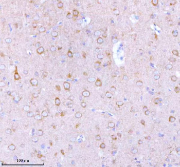 Immunohistochemical staining of STXBP6 using anti-STXBP6 antibody. STXBP6 was detected in a paraffin-embedded section of rat brain tissue. Heat mediated antigen retrieval was performed in EDTA buffer (pH 8.0, epitope retrieval solution). The tissue section was blocked with 10% goat serum. The tissue section was then incubated with 2 ug/ml rabbit anti-STXBP6 antibody overnight at 4oC. Peroxidase Conjugated Goat Anti-rabbit IgG was used as secondary antibody and incubated for 30 minutes at 37oC. The tissue section was developed using an HRP secondary and DAB substrate.