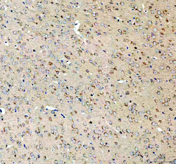 Immunohistochemical staining of SEZ6L2 using anti-SEZ6L2 antibody. SEZ6L2 was detected in a paraffin-embedded section of mouse brain tissue. Heat mediated antigen retrieval was performed in EDTA buffer (pH 8.0, epitope retrieval solution). The tissue section was blocked with 10% goat serum. The tissue section was then incubated with 2 ug/ml rabbit anti-SEZ6L2 antibody overnight at 4oC. Peroxidase Conjugated Goat Anti-rabbit IgG was used as secondary antibody and incubated for 30 minutes at 37oC. The tissue section was developed using an HRP secondary and DAB substrate.