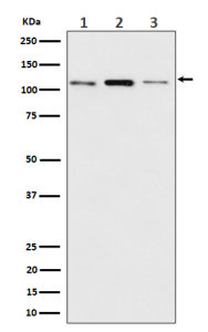 Western blot analysis of Meckelin/TMEM67 expression in (1) human MCF7 cell lysate; (2) mouse RAW 264.7 cell lysate; (3) rat C6 cell lysate using TMEM67 antibody. Expected molecular weight ~111 kDa, corresponding the the unglycosylated form of the protein.