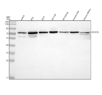 Western blot analysis of DHX58 using anti-DHX58 antibody. Electrophoresis was performed on a 10% SDS-PAGE gel at 80V (Stacking gel) / 120V (Resolving gel) for 2 hours. Lane 1: human Jurkat whole cell lysates, Lane 2: human RT4 whole cell lysates, Lane 3: human 293T whole cell lysates, Lane 4: rat liver tissue lysates, Lane 5: rat kidney tissue lysates, Lane 6: mouse liver tissue lysates, Lane 7: mouse kidney tissue lysates. After electrophoresis, proteins were transferred to a nitrocellulose membrane at 150 mA for 50-90 minutes. Blocked the membrane with 5% non-fat milk/TBS for 1.5 hour at RT. The membrane was incubated with rabbit anti-DHX58 antibody at 0.5 ug/ml overnight at 4oC, then washed with TBS-0.1%Tween 3 times with 5 minutes each and probed with a goat anti-rabbit IgG-HRP secondary antibody at a dilution of 1:5000 for 1.5 hour at RT. The signal was developed using an ECL Plus Western Blotting Substrate. A specific band was detected for DHX58 at approximately 77 kDa. The expected molecular weight of DHX58 is ~77 kDa.
