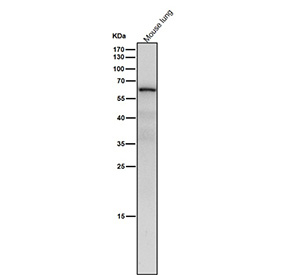Mouse lung tissue lysate western blot tested with the NR2C2 antibody at 1:4000 dilution for 1 hour at room temperature. Predicted molecular weight: 65-67 kDa (two isoforms).