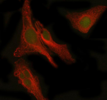 Immunofluorescent staining of PEPD using anti-PEPD antibody (green) and anti-Beta Tubulin antibody (red). PEPD was detected in immunocytochemical section of human HELA cell. Enzyme antigen retrieval was performed using IHC enzyme antigen retrieval reagent for 15 mins. The cells were blocked with 10% goat serum. And then incubated with 5 ug/ml rabbit anti-PEPD antibody and mouse anti-Beta Tubulin antibody overnight at 4oC. DyLight 488 Conjugated Goat Anti-Rabbit IgG and Cy3 Conjugated Goat Anti-Mouse IgG were used as secondary antibody at 1:500 dilution and incubated for 30 minutes at 37oC. Visualize using a fluorescence microscope and filter sets appropriate for the label used.