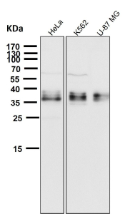 All lanes use the GGH antibody at 1:1000 dilution for 1 hour at room temperature. Western blot analysis of GGH using anti-GGH antibody. A principal band is observed at ~36 kDa with additional closely migrating bands, consistent with reported glycosylated and proteolytically processed forms of GGH.